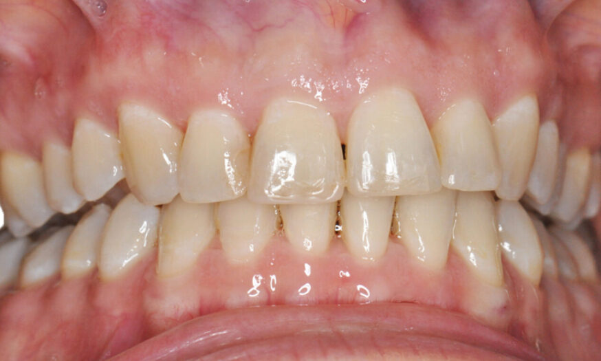 After - NB Dental