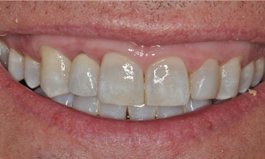 After - NB Dental