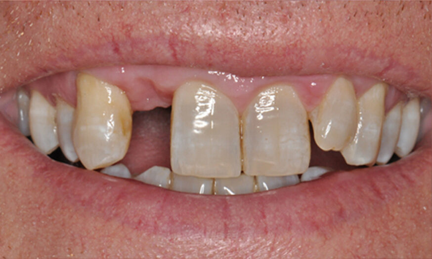 Before - NB Dental
